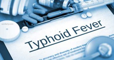 typhoid fever