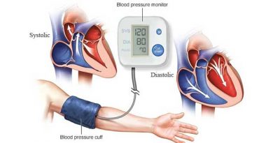 Blood pressure monitor