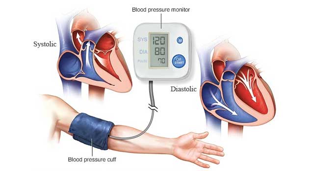 Blood pressure monitor
