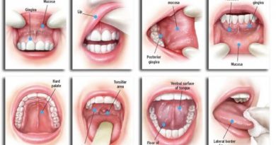 ওরাল ক্যান্সার