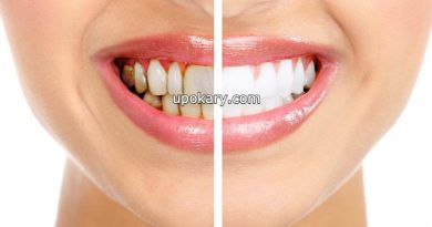 black spots on teeth