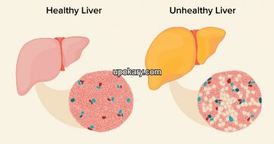 Fatty Liver
