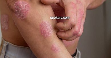 eczema
