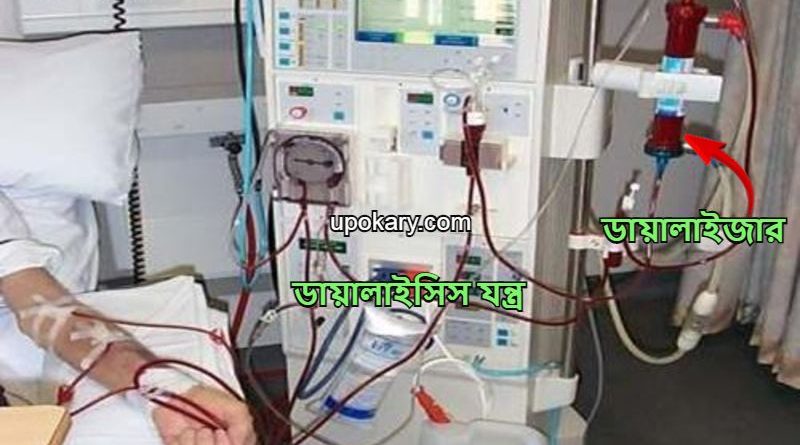 Dialysis