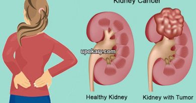 KidneyCancer