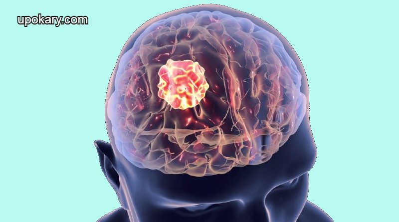 Brain Tumor