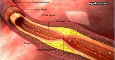 LDL cholesterol