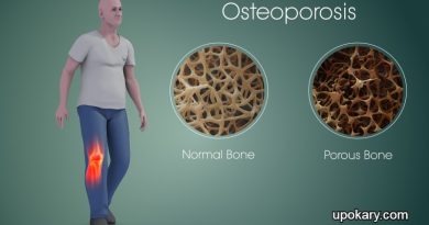 Osteoporosis