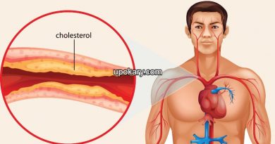 cholesterol