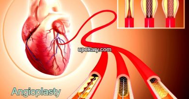Angioplasty