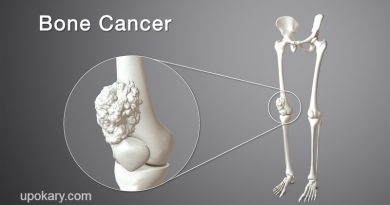হাড়ের ক্যান্সার