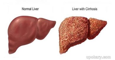অ্যালকোহল সম্পর্কিত লিভারের রোগ