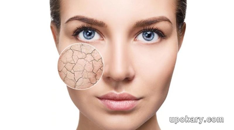 শুষ্ক ত্বক