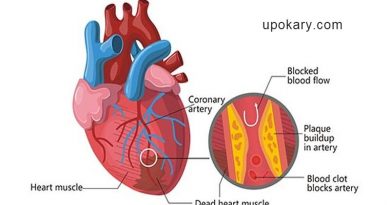 হার্ট অ্যাটাক