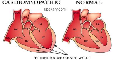 কার্ডিওমায়োপ্যাথি